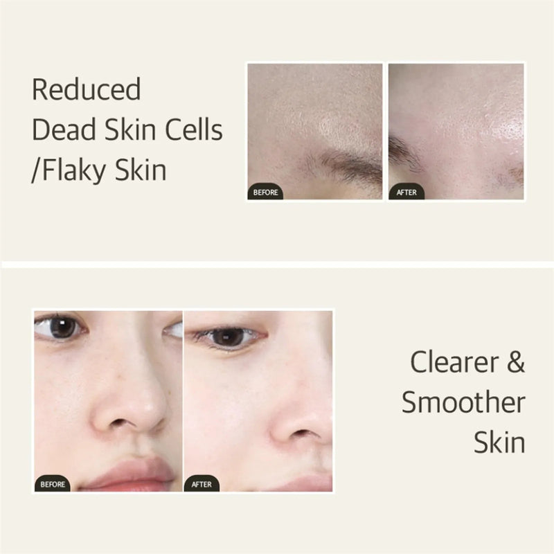 Mixsoon Bean Essence – Hidratação Profunda e Renovação Suave