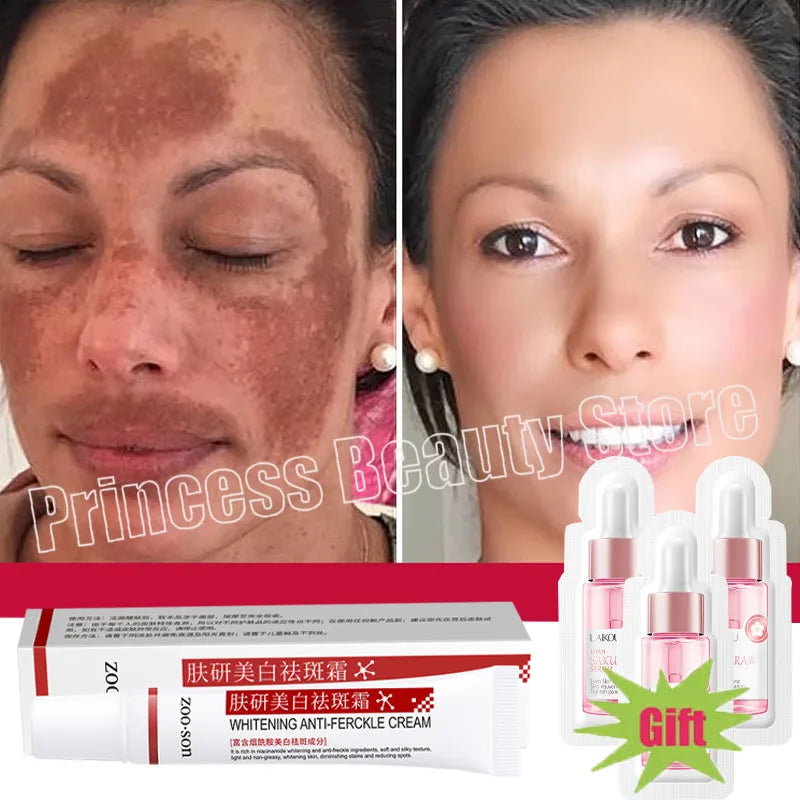 Creme Clareador Coreano – Elimine Manchas e Ilumine Sua Pele