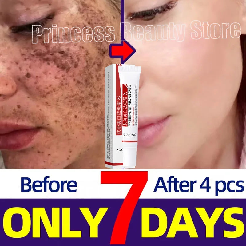 Creme Clareador Coreano – Elimine Manchas e Ilumine Sua Pele