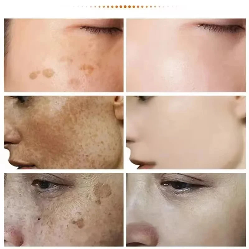 Creme Clareador Coreano – Elimine Manchas e Ilumine Sua Pele