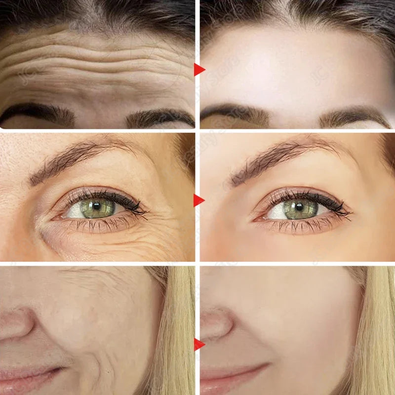 Conjunto Facial Anti-Idade Coreano Original – Tratamento Completo para uma Pele Jovem e Renovada
